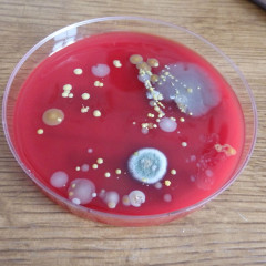 Kultivace bakterií 8.,9. třída